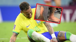 Neymar pokazał nowe zdjęcia po kontuzji. Tak wygląda jego kostka