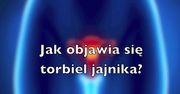 Jak objawia się torbiel jajnika? (WIDEO)