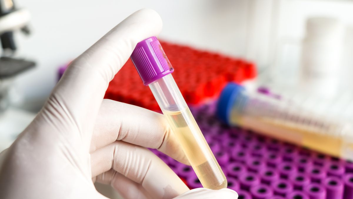 Badanie stężenia cAMP warto wykonać w przypadku podejrzenia niedoczynności przytarczyc.