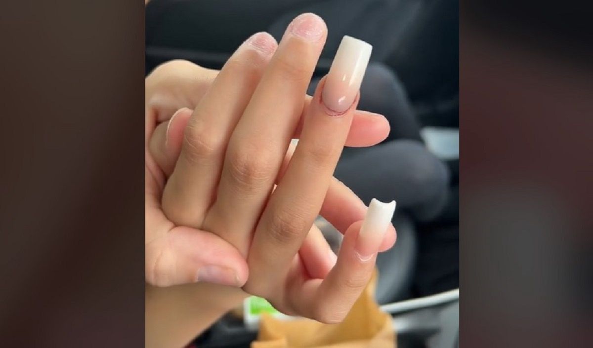 Mama 10-latki ostrzega. Mówi, co się stało z paznokciami jej córki