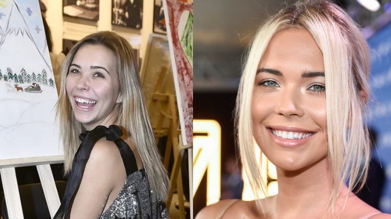 Najdroższe uśmiechy gwiazd