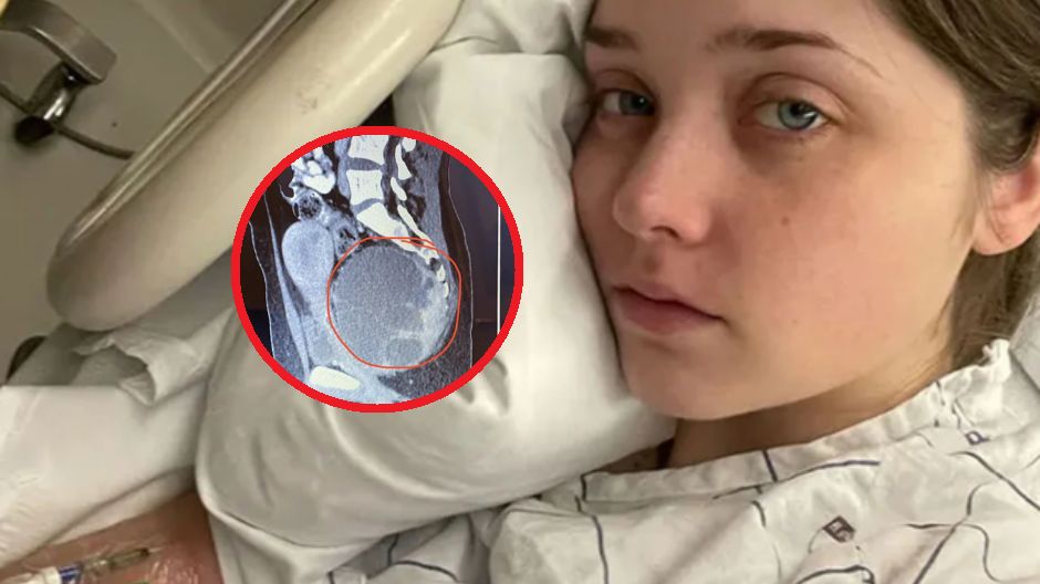 Guz był wielkości główki dziecka