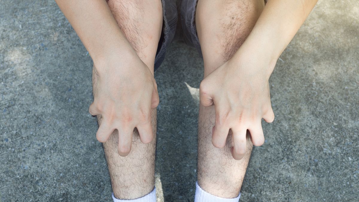 Midsection Of Man Scratching Legs While Sitting On Floor
Tharakorn Arunothai / EyeEm