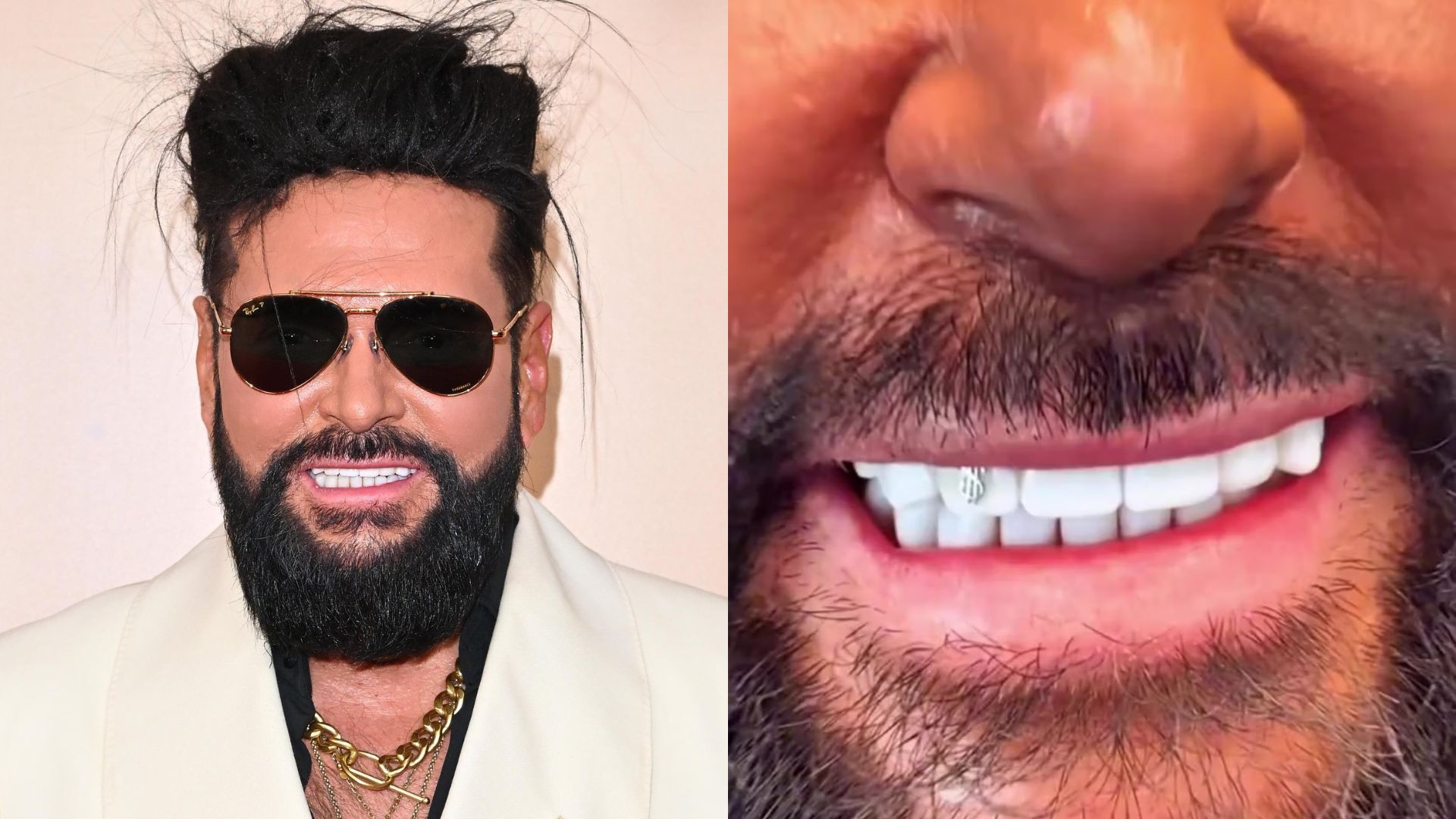 Krzysztof Rutkowski i nowe zęby