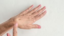 Usuwanie ganglionów - charakterystyka, przyczyny, objawy, przebieg, operacja