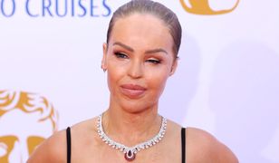 Katie Piper przeszła 400 operacji po oblaniu kwasem. Dziś z dumą pozuje na ściance