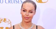 Katie Piper przeszła 400 operacji po oblaniu kwasem. Dziś z dumą pozuje na ściance