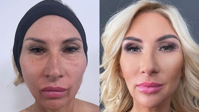 "Młodość na zamówienie". Metamorfoza Martiny zachwyciła jej przyjaciółki