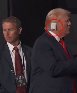 Trump zamilkł. Uwaga wszystkich skupiła się na jego uchu