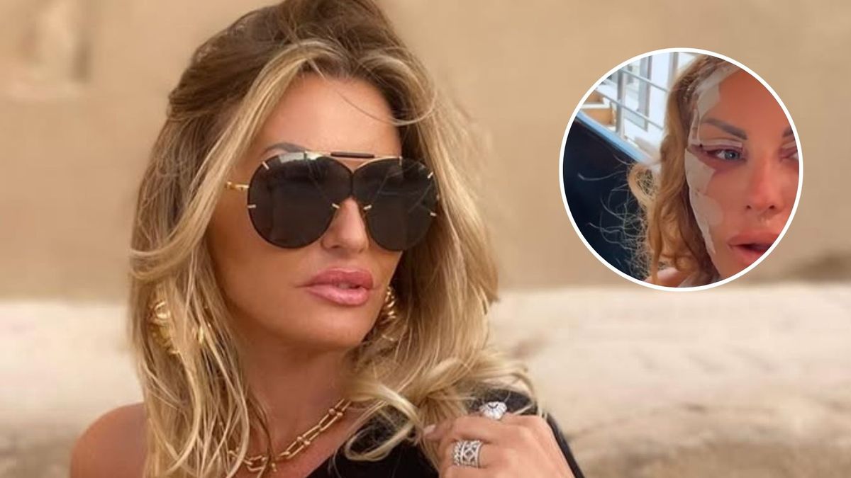 Dagmara Kaźmierska przeszła operację