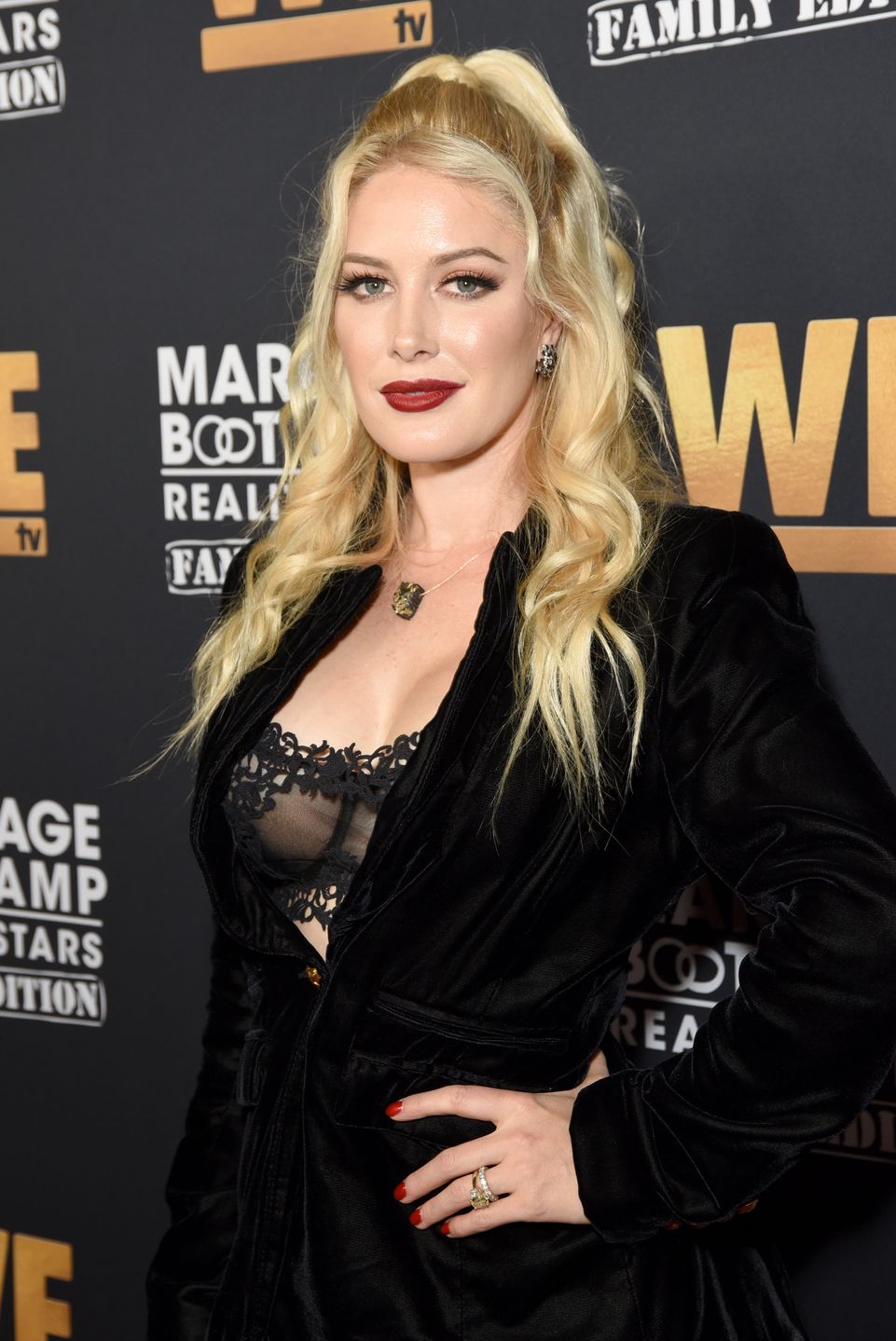 Tak wygląda Heidi Montag po operacjach plastycznych 