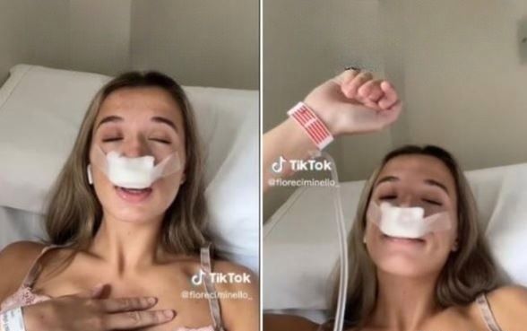 Napisała, że przeszła operację nosa dla dziecka 