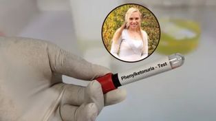 Cierpi na rzadkie zaburzenie. Adoptowała dziecko z tym samym schorzeniem