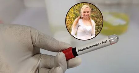 Cierpi na rzadkie zaburzenie. Adoptowała dziecko z tym samym schorzeniem