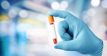 Cytogenetyka molekularna - charakterystyka, metody, diagnozowane choroby