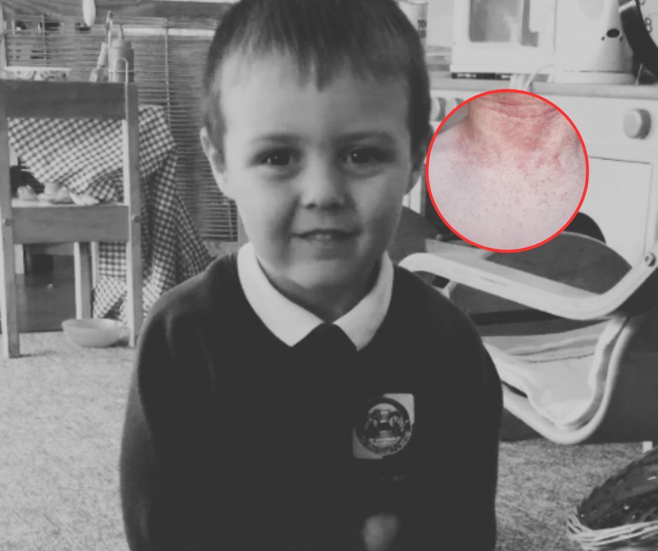 Myśleli, że to zwykła wysypka. 5-latek zmarł