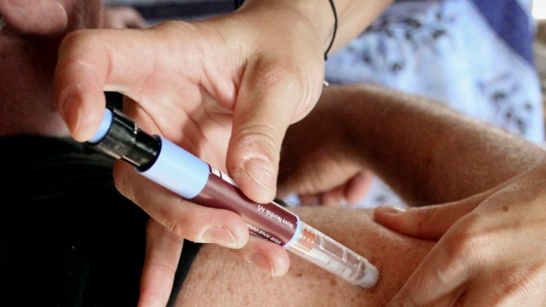 Lipoatrofia to rzadkie powikłanie insulinoterapii, które objawia się zanikiem podskórnej tkanki tłuszczowej. 