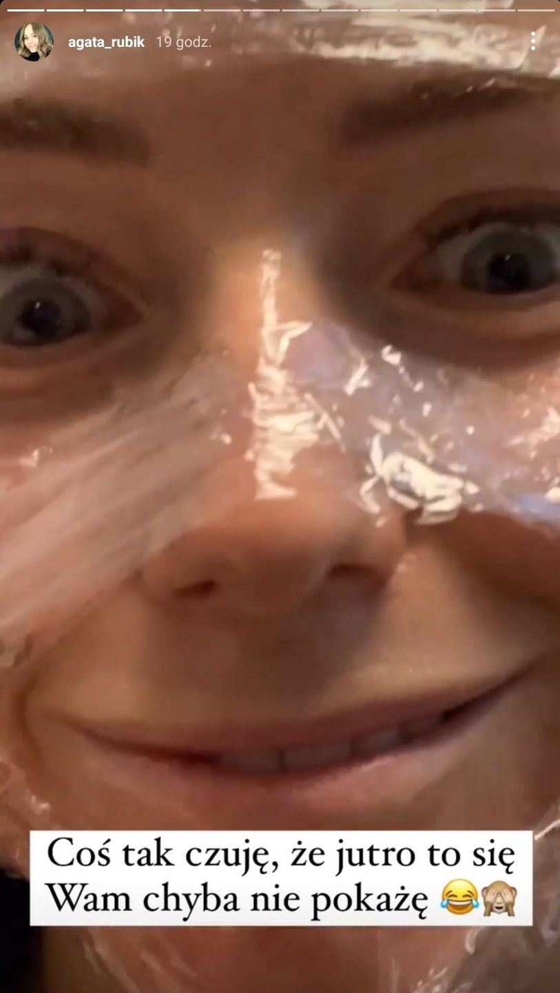 Agata Rubik relacjonuje zabieg laserowy i pokazuje opuchliznę 