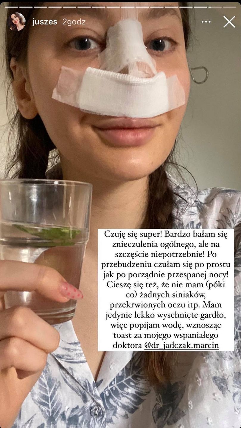 Justyna z "Big Brothera" przeszła operację plastyczną nosa