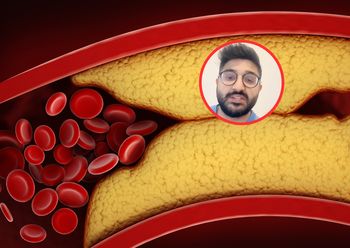 Skuteczny sposób na zbicie cholesterolu. "Najwięcej dowodów naukowych"