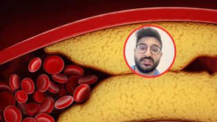 Skuteczny sposób na zbicie cholesterolu. "Najwięcej dowodów naukowych"