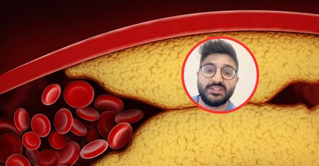Skuteczny sposób na zbicie cholesterolu. "Najwięcej dowodów naukowych"