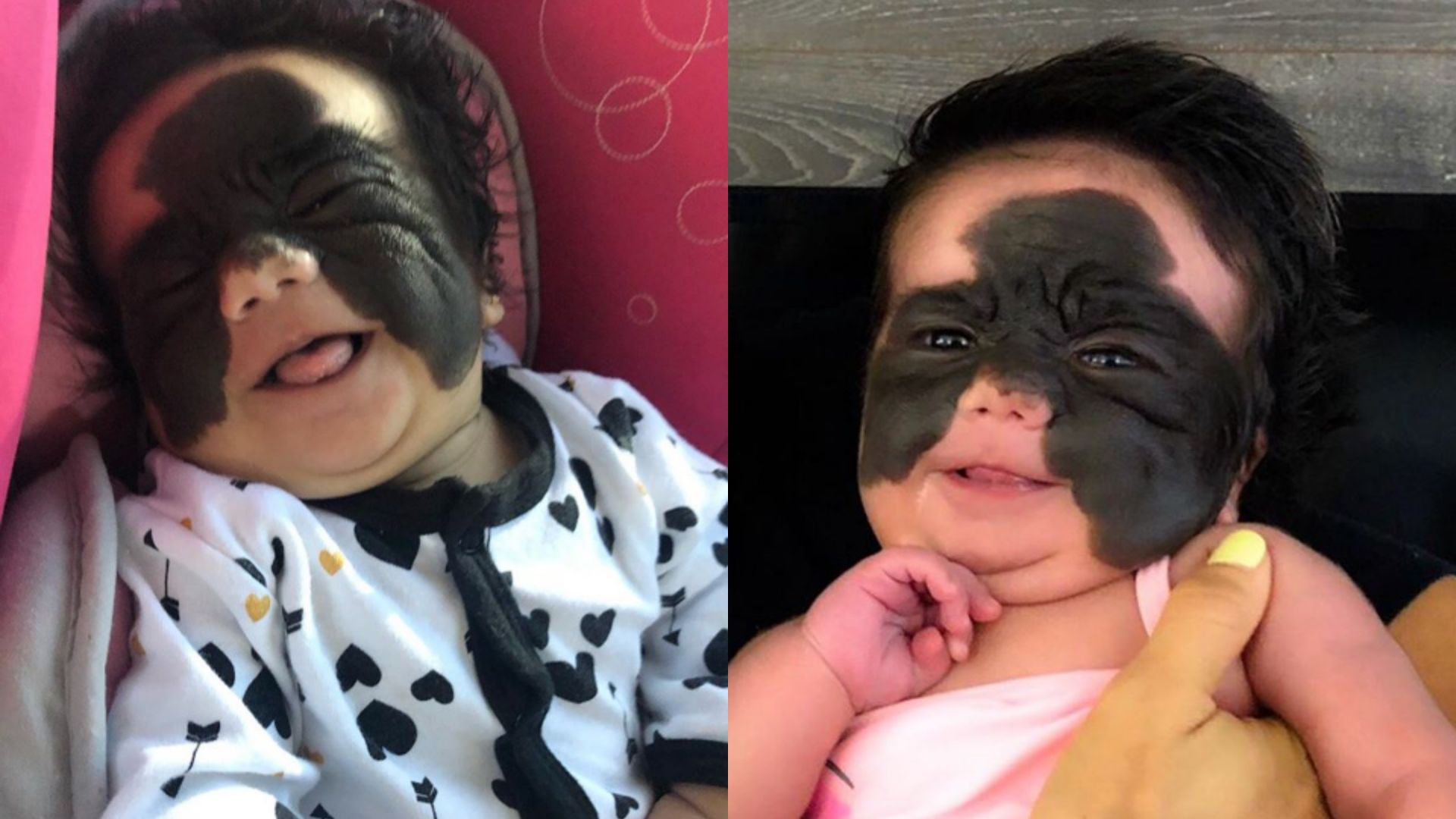 Gigantyczne znamię na twarzy Luny to wada genetyczna