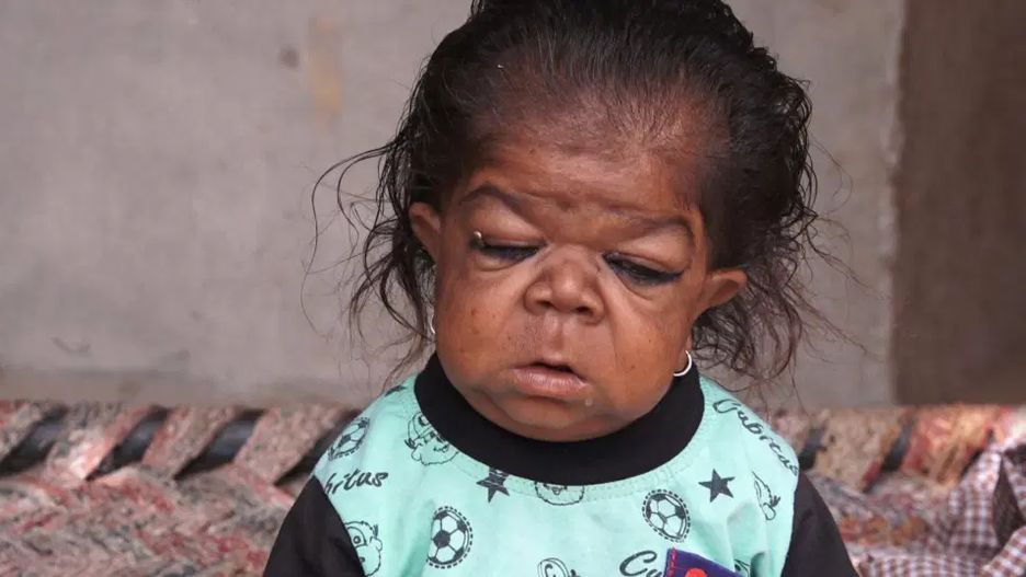 25-latek uwięziony w ciele niemowlaka