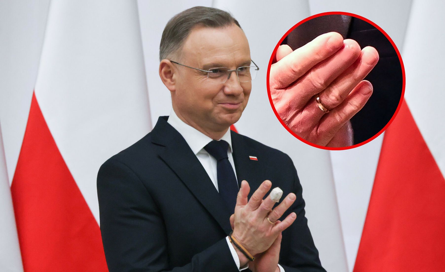 wiadomości,aktualności,WP Wiadomości Kontuzja Dudy. Były prezydent ujawnia. 