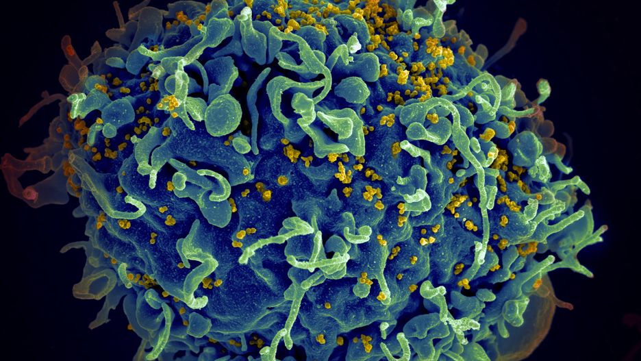 Wirus HIV