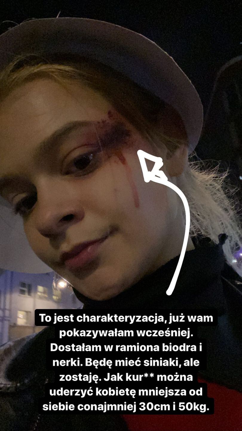 Julia Wróblewska została pobita na Strajku Kobiet w Warszawie