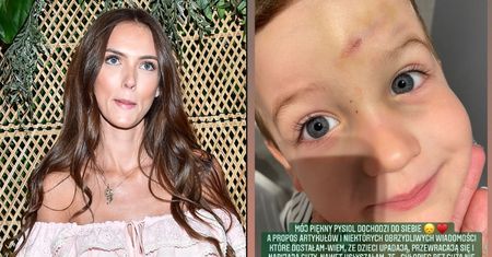 Marcela Leszczak pokazuje posiniaczoną twarz synka i deklaruje: "Wymodliłam W KOŚCIÓŁKU zdrowie dla mojego Frysia"