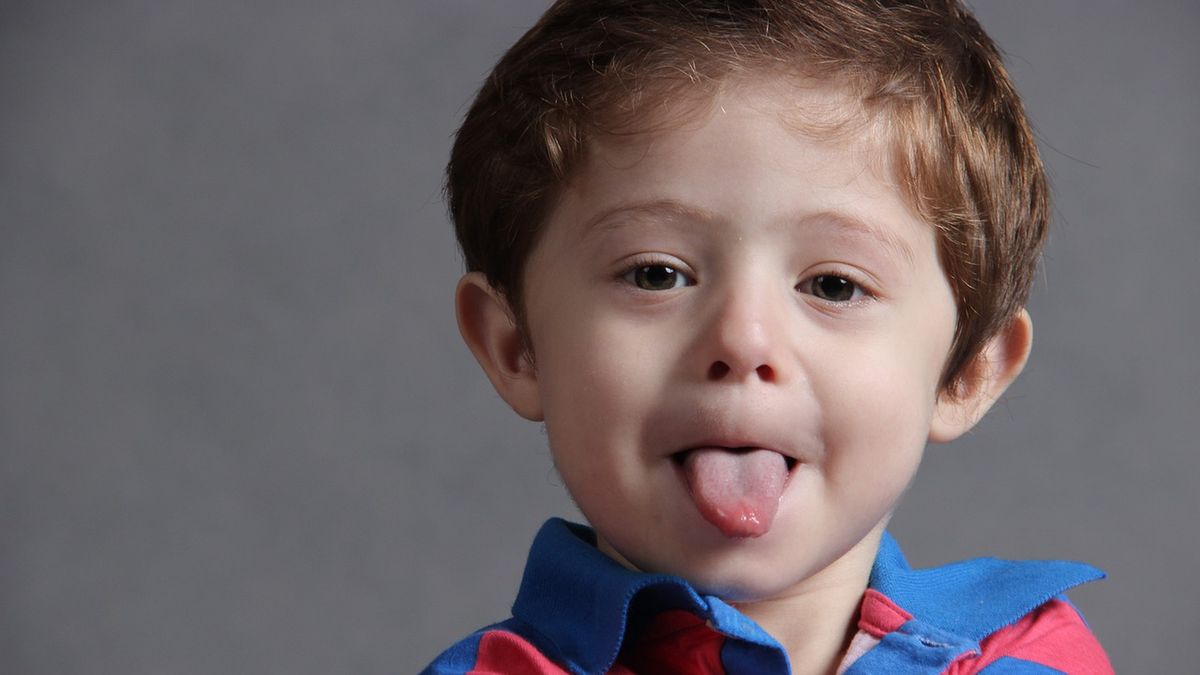 Obrzęk języka utrudnia oddychanie lub uniemożliwia przyjmowanie pokarmów lub płynów