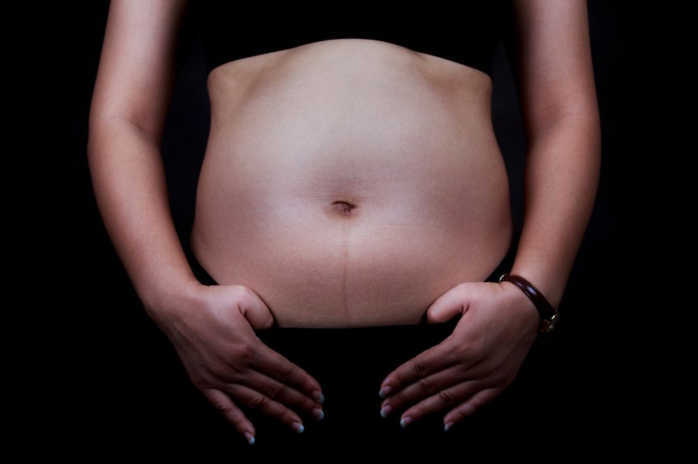 Rozstęp mięśni brzucha po porodzie - przyczyny. Ćwiczenia na brzuch po ciąży