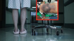 Nie leczyła cukrzycy. Lekarze pokazali, jak wyglądają jej plecy
