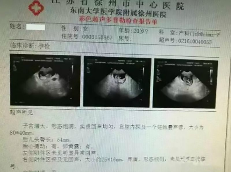 usg 12-latki / nextshark