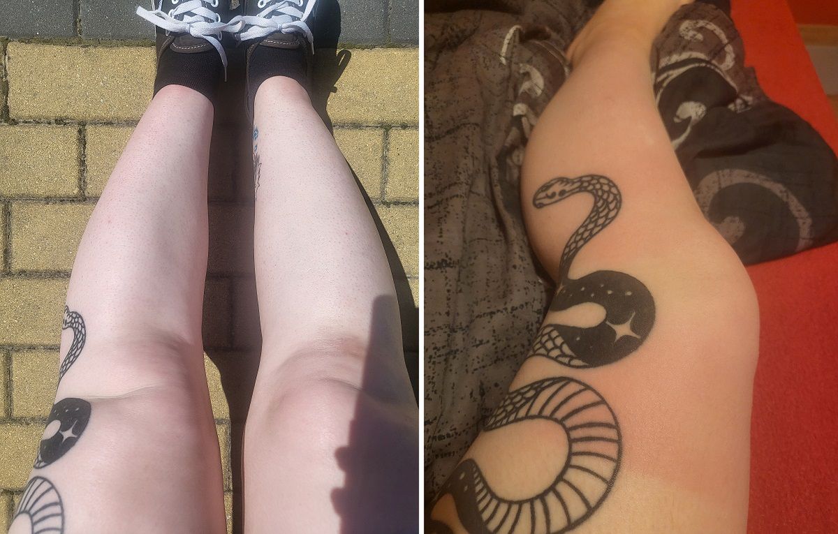 Tak wyglądały moje nogi po opalaniu