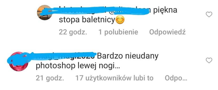 Małgorzata Rozenek - co z jej stopą?
