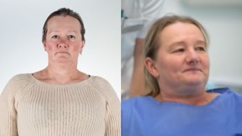 50-latka wstydziła się uśmiechać: "Mam KILKA ZĘBÓW u góry i kilka na dole". Tak teraz wygląda bohaterka programu Rozenek (FOTO)