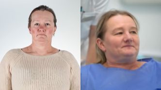 50-latka wstydziła się uśmiechać: "Mam KILKA ZĘBÓW u góry i kilka na dole". Tak teraz wygląda bohaterka programu Rozenek (FOTO)