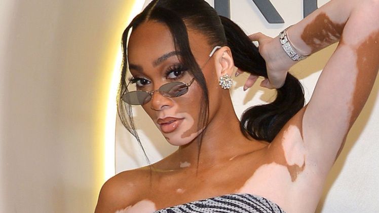 Winnie Harlow odsłania smukłe ciało w kusym komplecie na imprezie