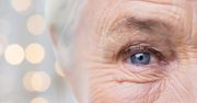 Zaćma. Ta choroba oczu dotyka wielu Polaków. Jakie są jej objawy?