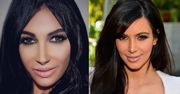 Psychofanka Kim wydała 30 tysięcy na operacje!