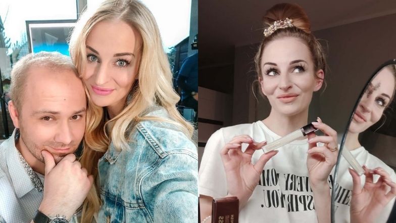 Anita ze "Ślubu od pierwszego wejrzenia" zafundowała sobie upiększający zabieg