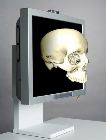 Medyczny ekran 3D kontrolowany gestami 1