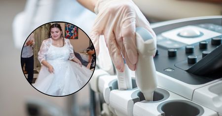 "Przykro mi, ale masz raka". 32-latka nie mogła uwierzyć w diagnozę