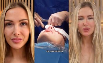 Eliza Trybała relacjonuje wizytę w klinice, w której sprawiła sobie PLASTYKĘ POWIEK: "Jestem trochę OSZOŁOMIONA"