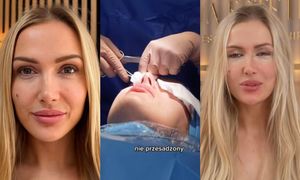 Eliza Trybała relacjonuje wizytę w klinice, w której sprawiła sobie PLASTYKĘ POWIEK: "Jestem trochę OSZOŁOMIONA"