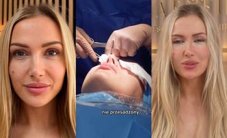 Eliza Trybała relacjonuje wizytę w klinice, w której sprawiła sobie PLASTYKĘ POWIEK: "Jestem trochę OSZOŁOMIONA"