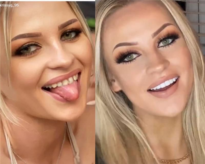 Zrobiła sobie "tureckie zęby". Tak wygląda!